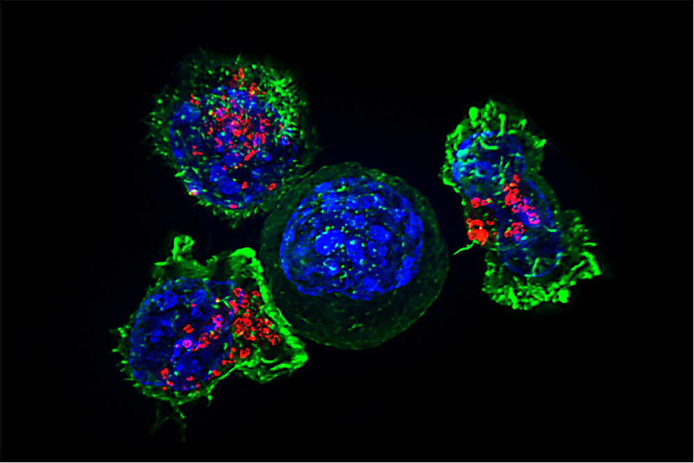 Preclinical model identifies predictors of checkpoint inhibitor response