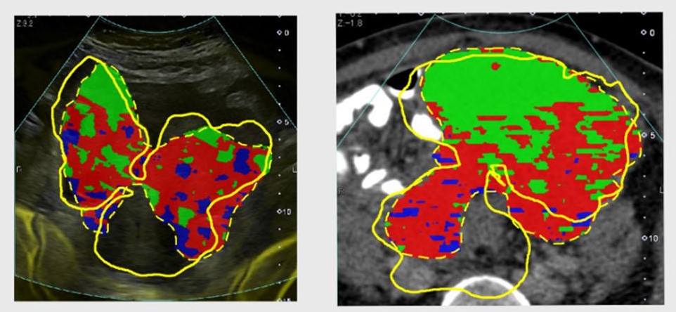 Integrated imaging opens the way for virtual biopsies