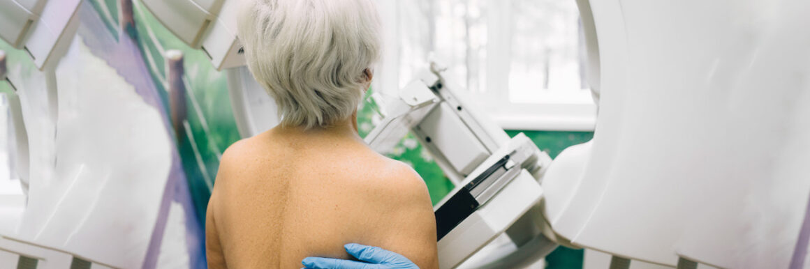 Fit, susceptible, or frail? Updated recommendations for managing breast cancer in older people
