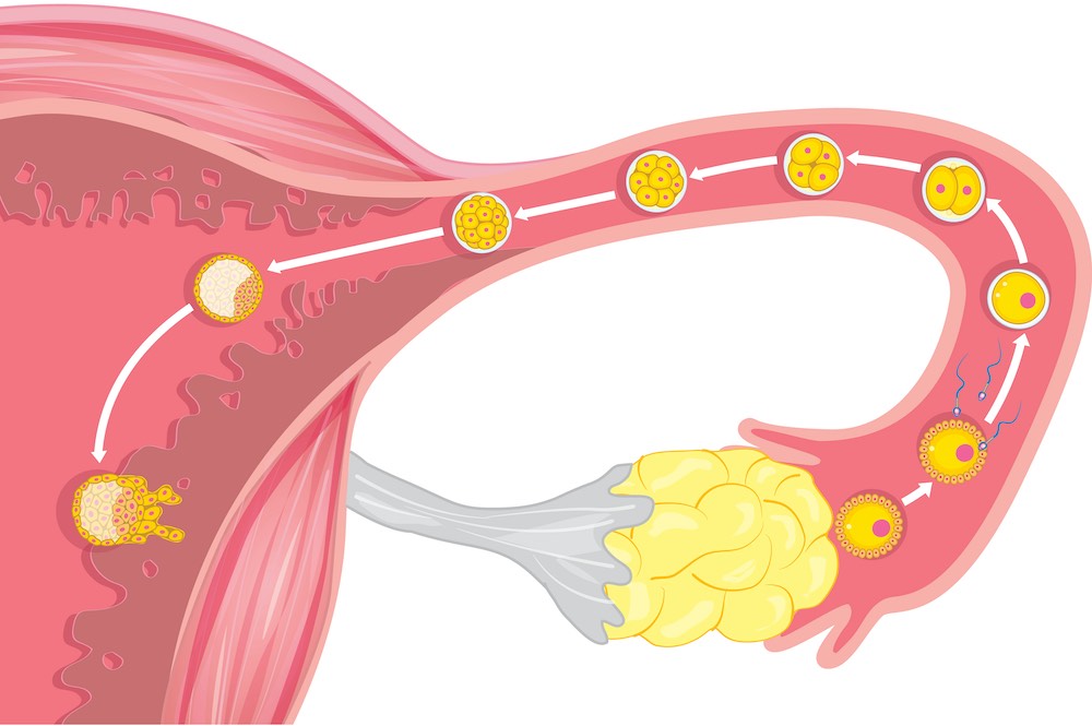 Epidemiological study sheds light on complex link between ovarian cancer and ovulation
