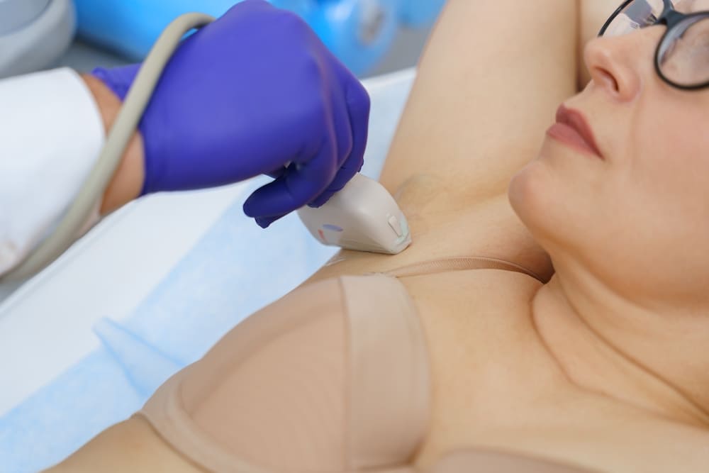 Trial defines breast cancer population who can omit sentinel node biopsy