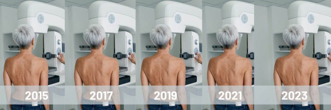 Regular mammography offers best insurance against dying from breast cancer