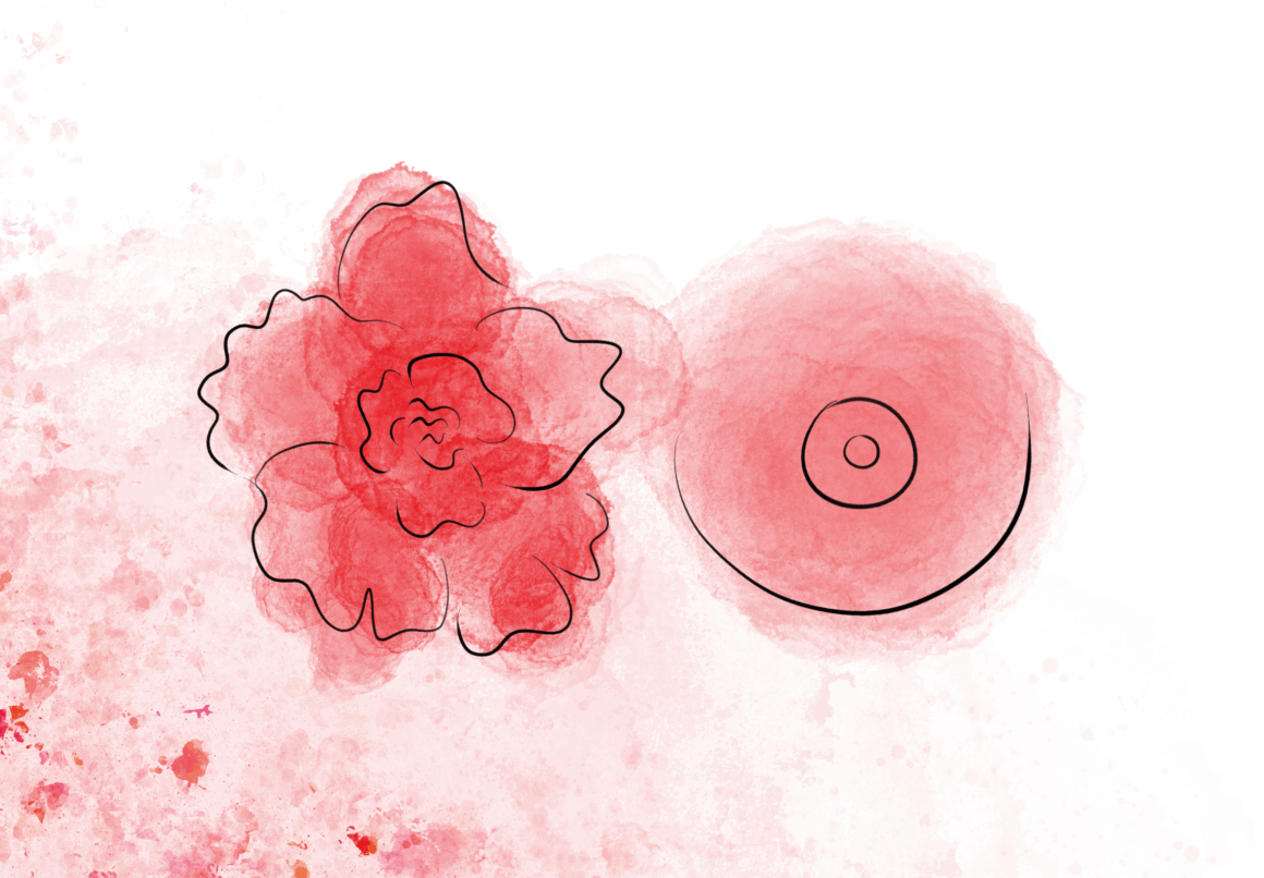 It’s no longer taboo to suggest that some metastatic breast cancers may be curable