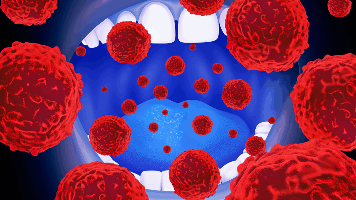 The Oral Microbiome as a Non-Invasive Biomarker for Early Detection of Pancreatic Cancer Risk