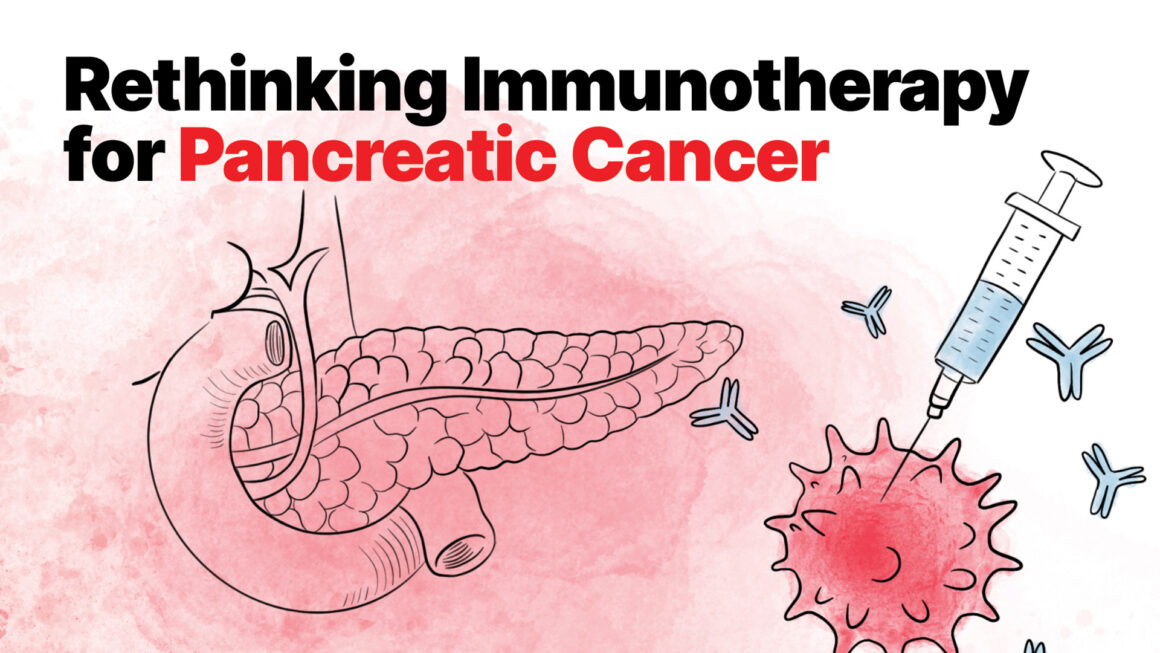 Rethinking Immunotherapy for Pancreatic Cancer: A Universal Approach
